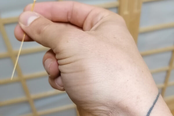 Acupuncture Training Clinic - International Academy of Acupuncture