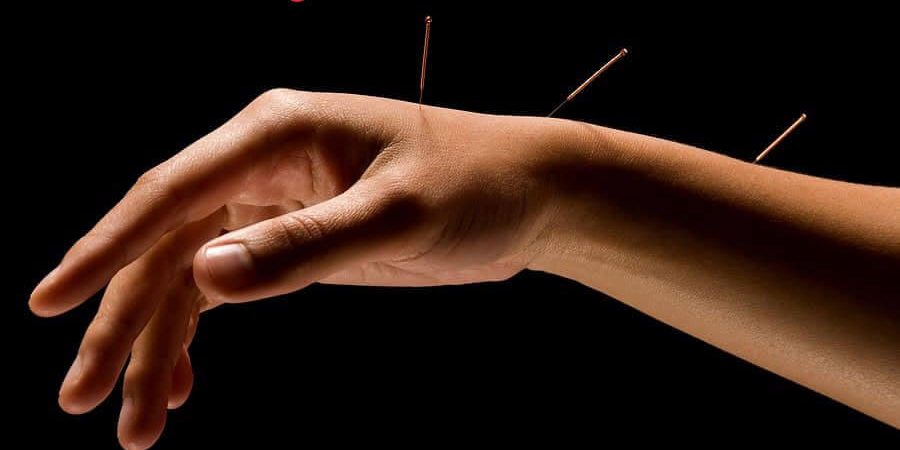 Εκαπίδευση στο Βελονισμό Εκαπίδευση στο Βελονισμό