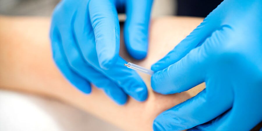 advanced-dry-needling Trigger Point Dry Needling // Εκπαίδευση στην τεχνική της "ξηράς βελόνας"